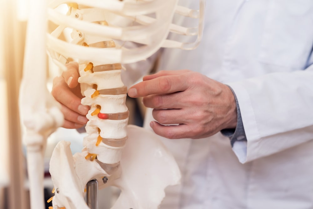 Osteopath pointing at model of lower spine near sciatic nerve